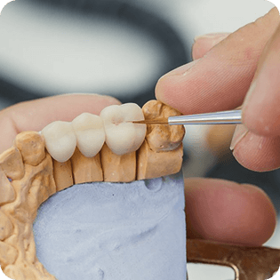 bridge implants chevreuse restauration complete Accueil Cabinet Dental Vallée | Dentistes Chevreuse