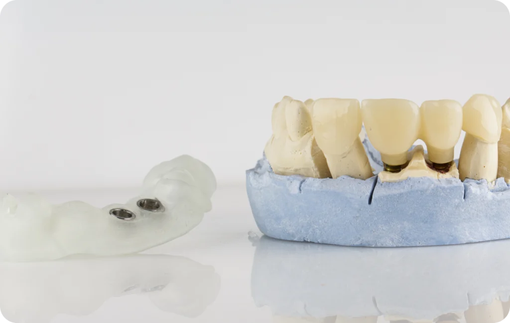 chirurgie dentaire guidee chevreuse Chirurgie guidée Cabinet Dental Vallée | Dentistes Chevreuse