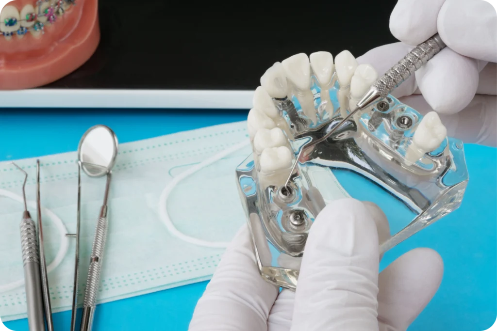 chirurgie dentaire guidee dents chevreuse Chirurgie guidée Cabinet Dental Vallée | Dentistes Chevreuse