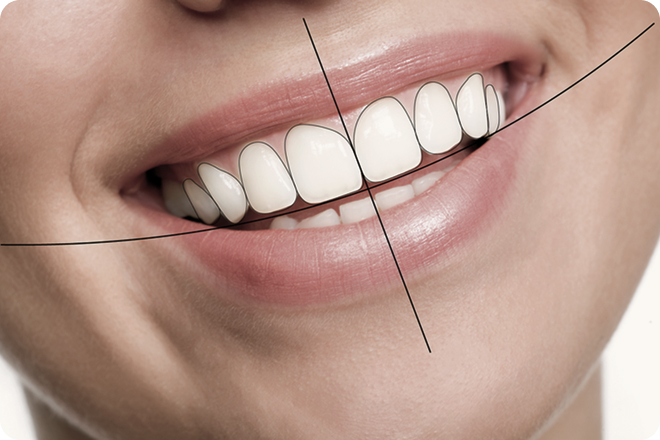 facettes dentaires chevreuse sourire harmonieux Nos technologies Cabinet Dental Vallée | Dentistes Chevreuse