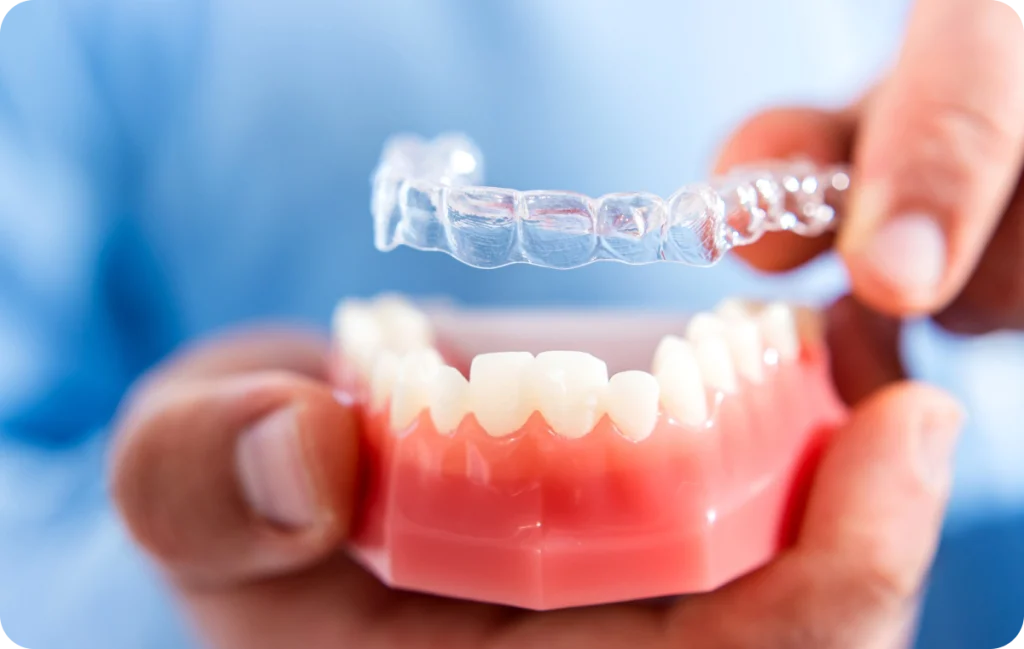 aligneurs invisibles chevreuse confort traitement Aligneurs invisibles Cabinet Dental Vallée | Dentistes Chevreuse