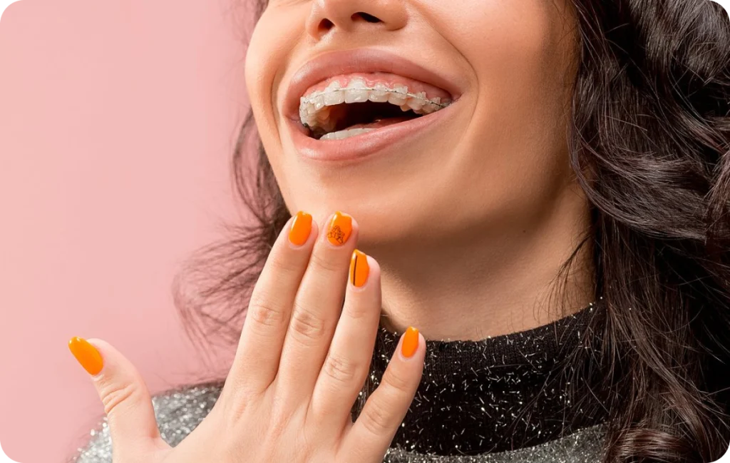 appareils dentaires ceramique chevreuse appareils dentaires ceramique chevreuse Appareils dentaires Cabinet Dental Vallée | Dentistes Chevreuse