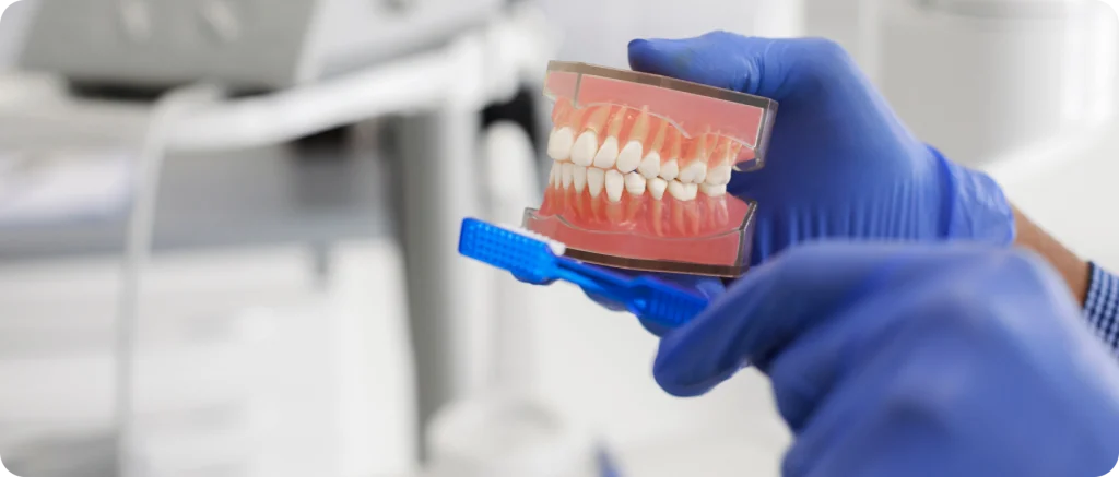 blanchiment dentaire chevreuse teinte naturelle blanchiment dentaire chevreuse teinte naturelle Prévention, dépistage des maladies parodontales Cabinet Dental Vallée | Dentistes Chevreuse